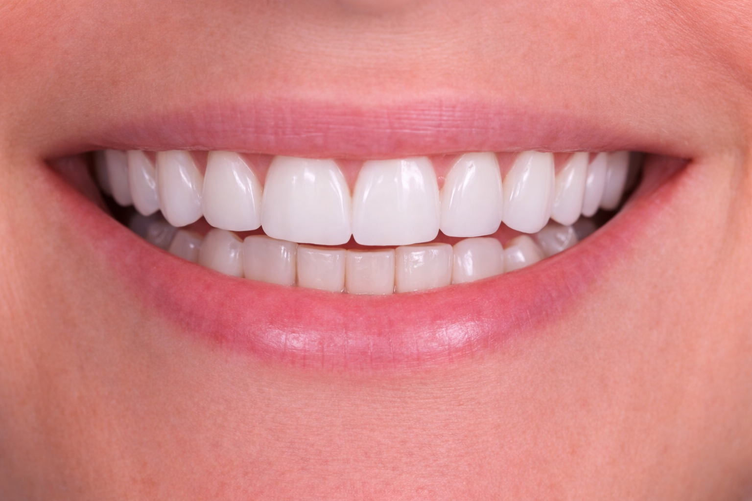 The Dental Way Bergenfield before and after smile result